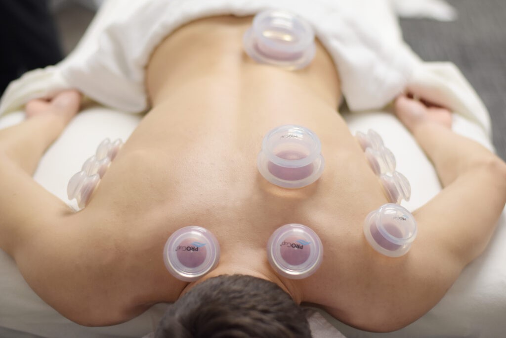 Homme couché sur le ventre avec de multiples ventouses dans son dos